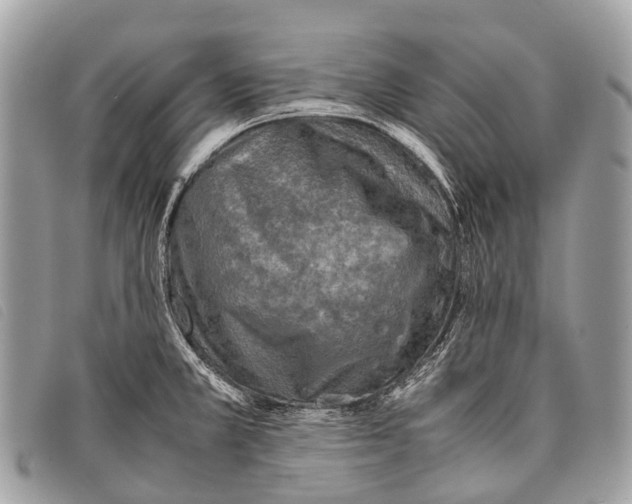 X0000097861381200804111142