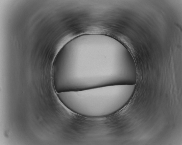 X0000097871487200803140907