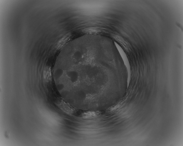 X0000097870381200803281207
