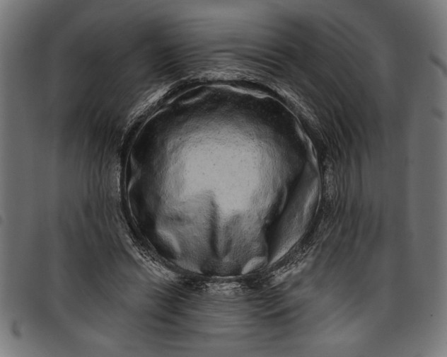X0000097870446200803281205