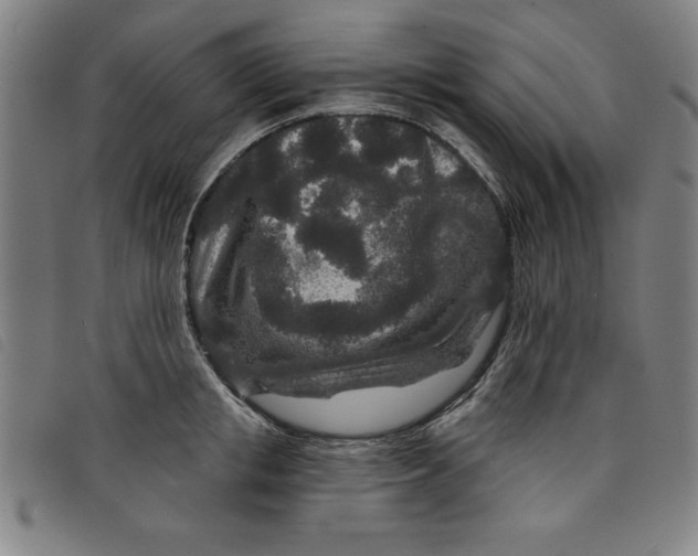 X0000097870853200804041549