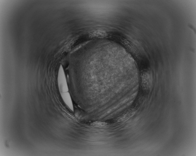 X0000097880617200803281225