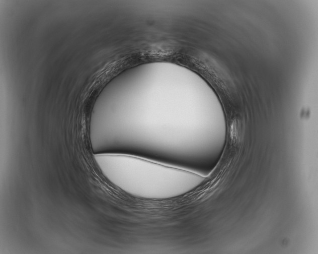 X0000097901299200803140957