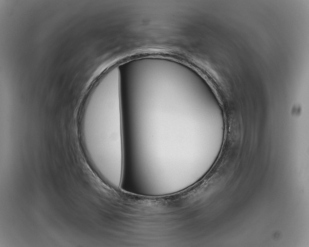 X0000097901404200803140956