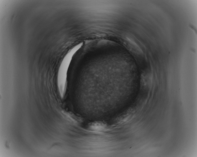 X0000097900223200803141401