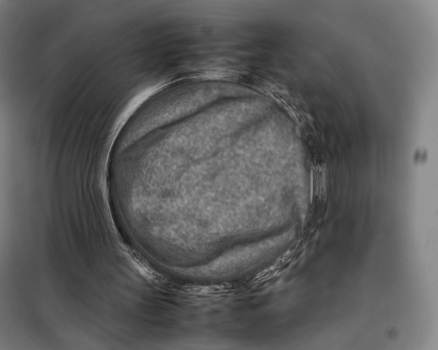 X0000097900147200804041445