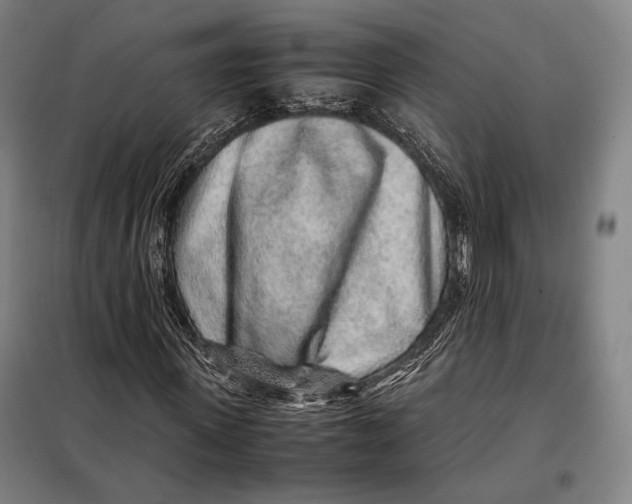 X0000097900915200804041434