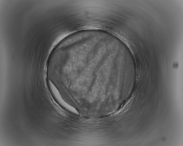 X0000097901179200804041430