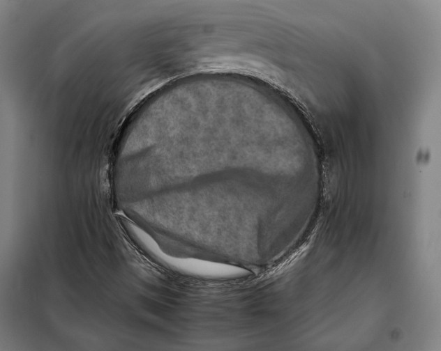 X0000097901497200804041425