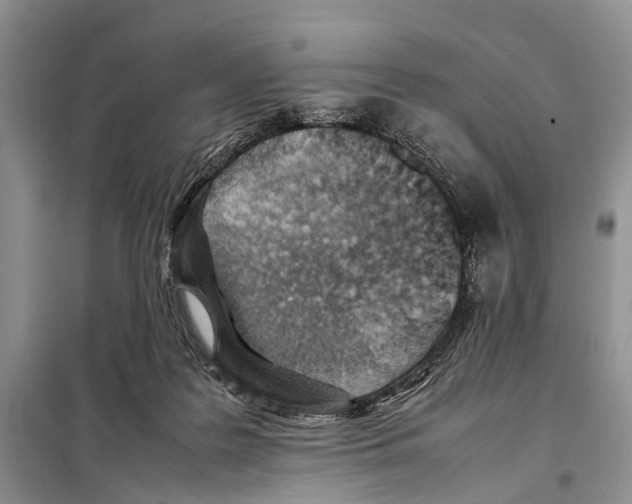 X0000097900219200804111053