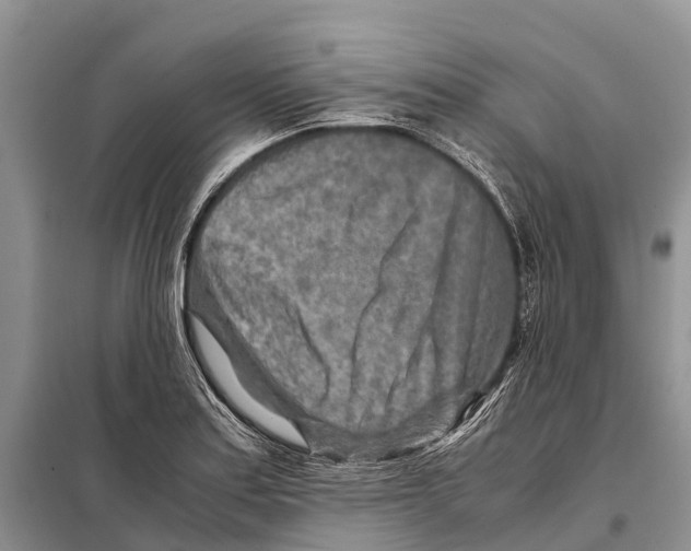 X0000097901179200804111036