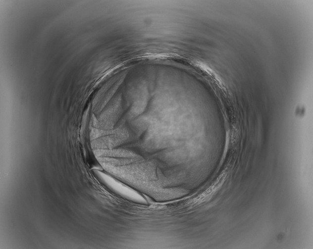 X0000097901353200804111033