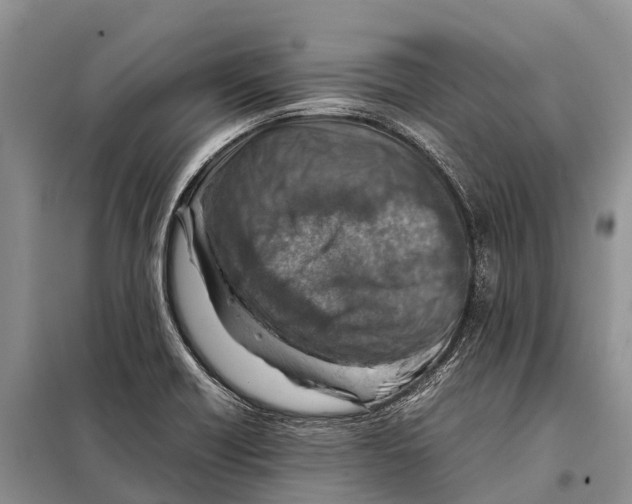 X0000097901418200804111032