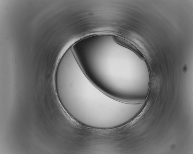 X0000097911196200803141022