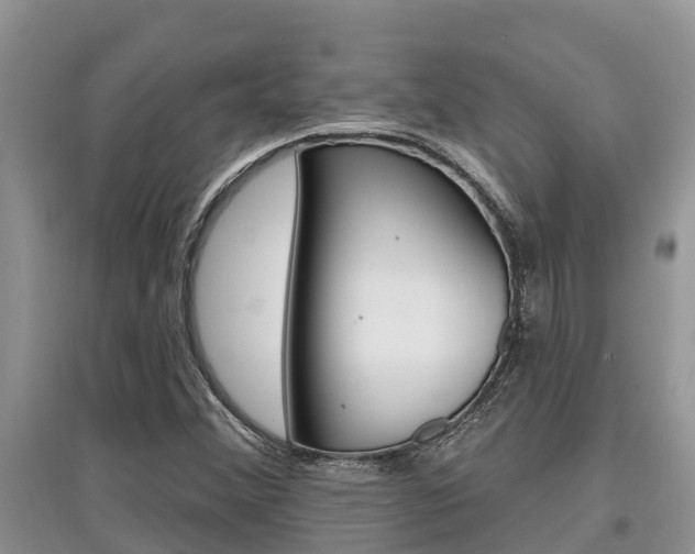 X0000097911356200803141020