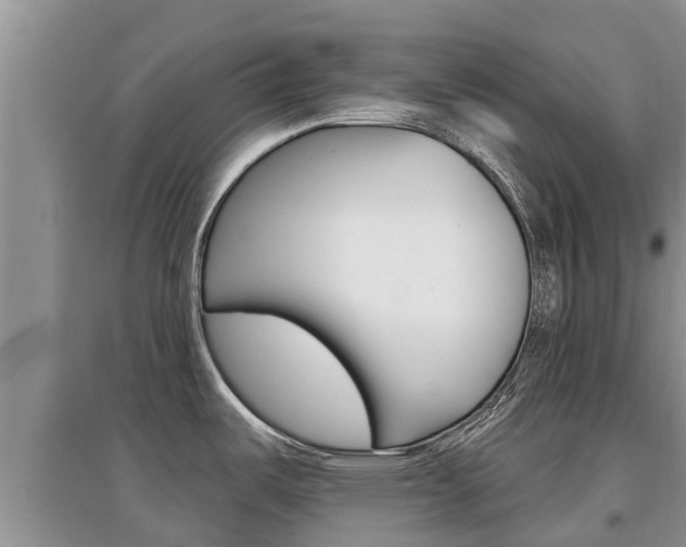 X0000097911487200803141018