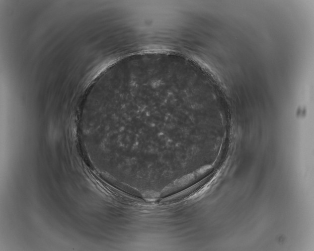 X0000097911401200803141407