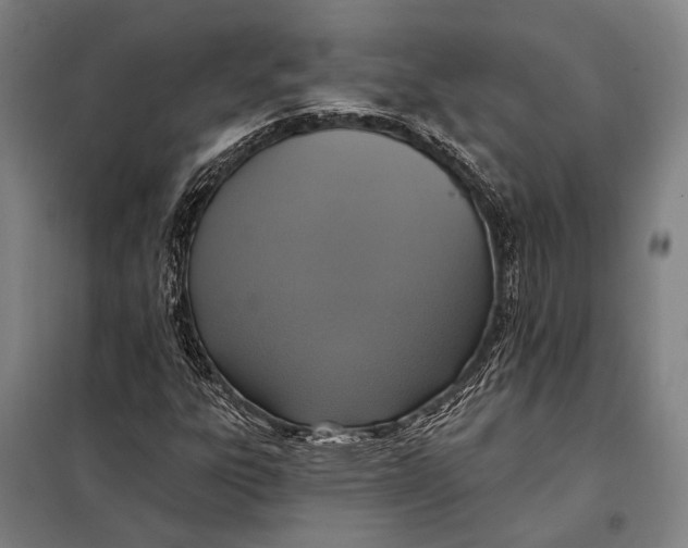 X0000097911303200804041452