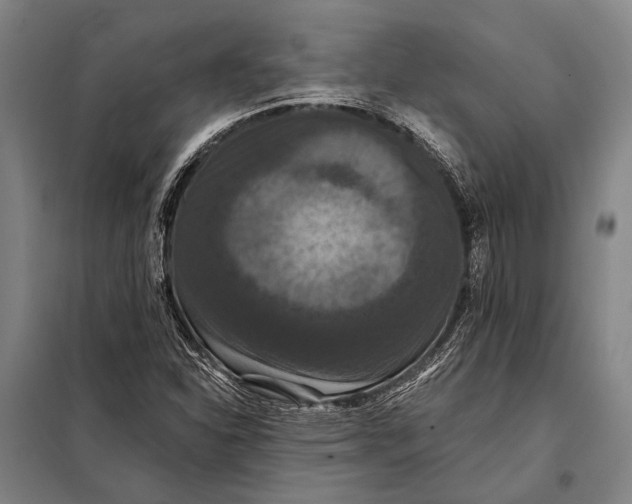 X0000097911310200804041452