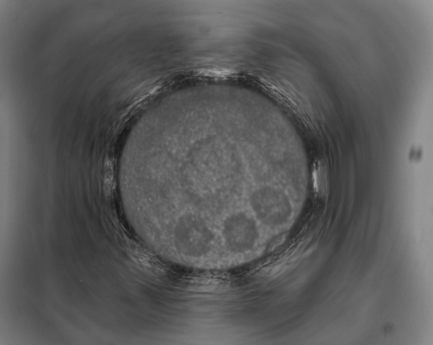 X0000097911347200804041451