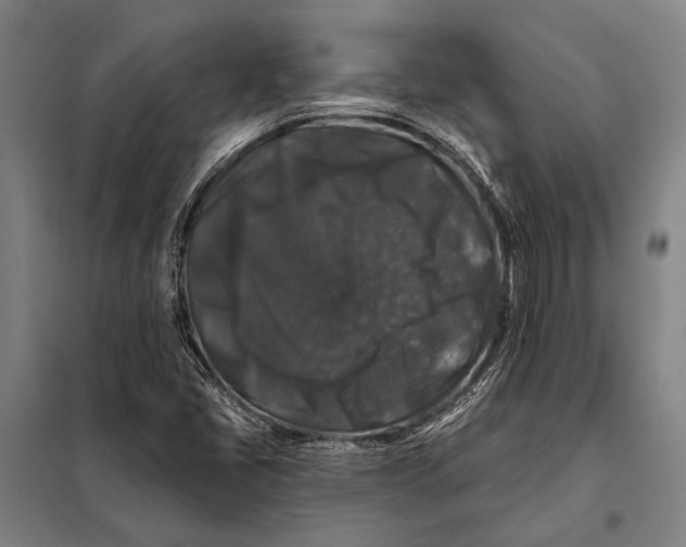 X0000097911405200804041450