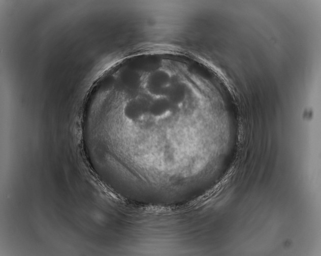 X0000097911407200804041450