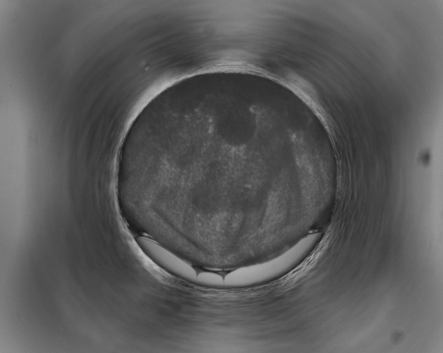 X0000097911438200804041451