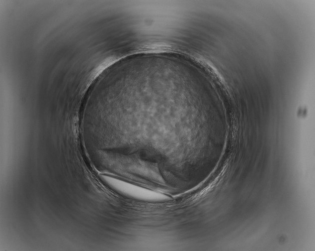 X0000097911457200804041450