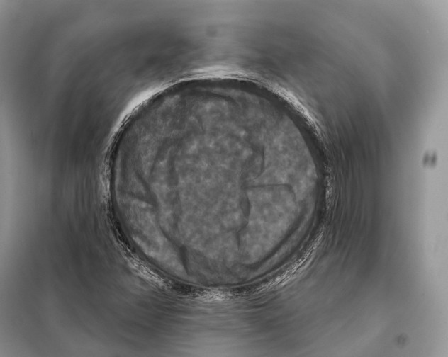 X0000097911358200804111101