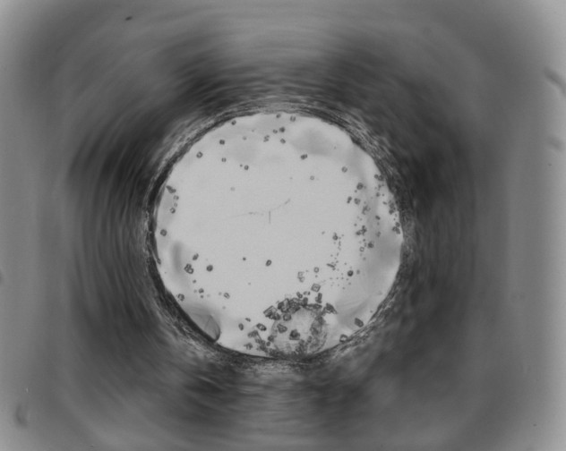X0000097920146200803141038