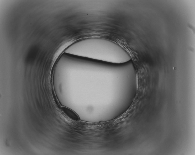 X0000097920147200803141038