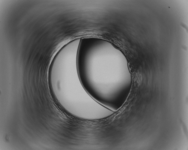 X0000097920148200803141038