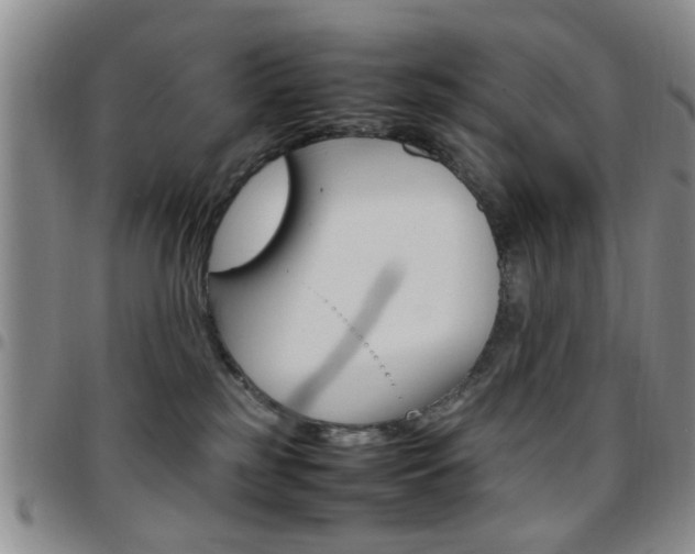 X0000097920185200803141039