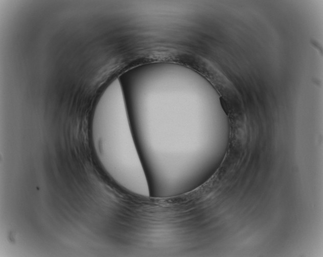 X0000097920696200803141031