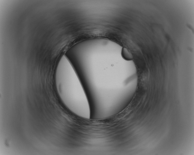 X0000097920746200803141030