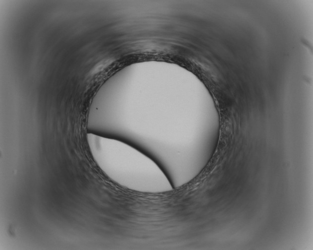 X0000097920869200803141028