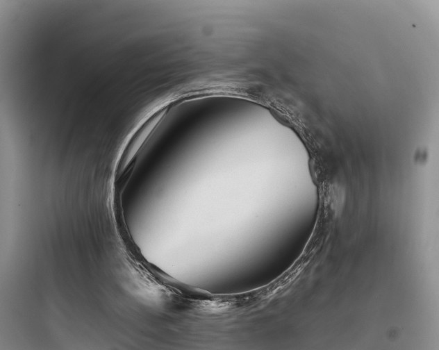 X0000097920148200803211535