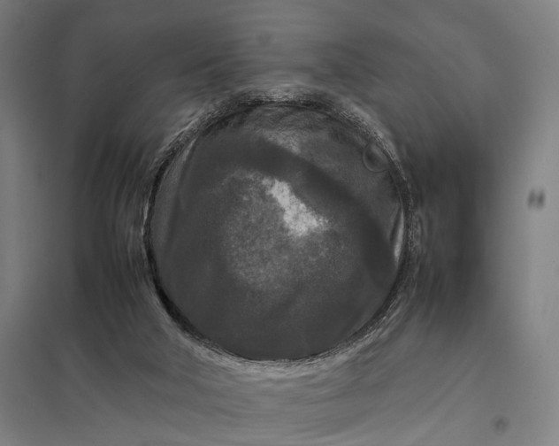 X0000097920018200803281436