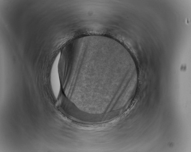 X0000097920017200804041534