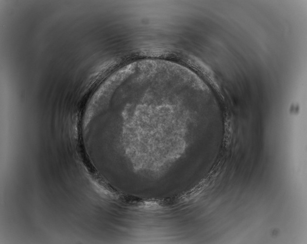 X0000097920114200804041533