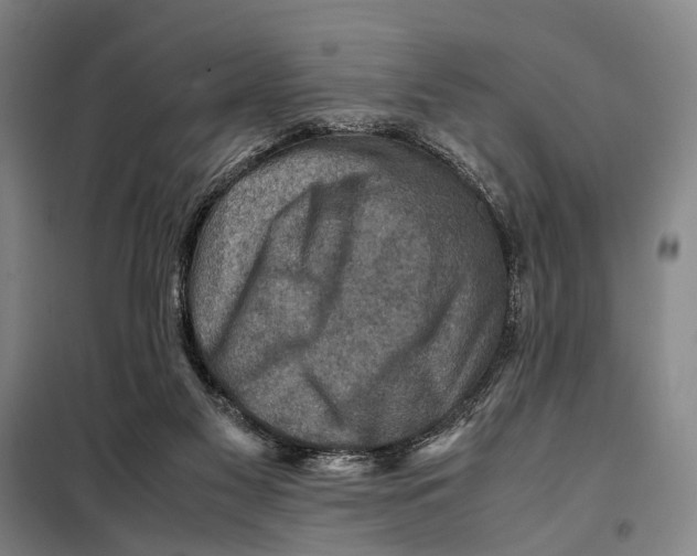 X0000097920117200804041533