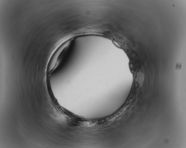 X0000097920148200804041532