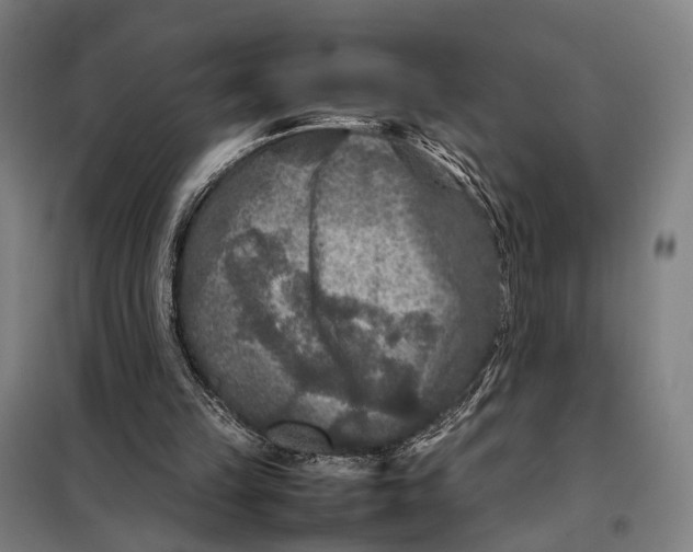 X0000097920149200804041532