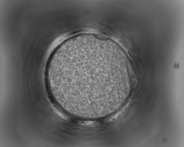 X0000097920151200804041532