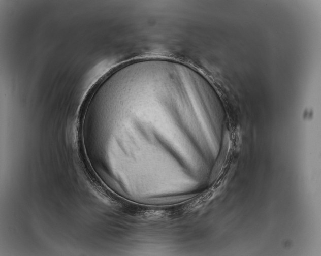 X0000097920152200804041532