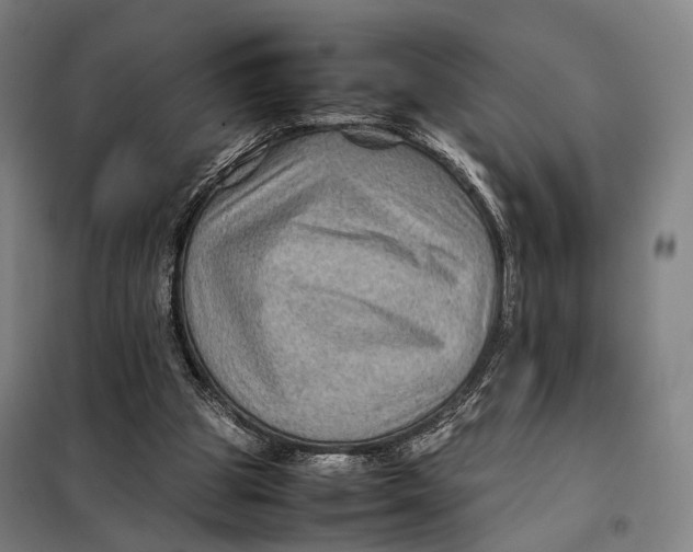 X0000097920153200804041532