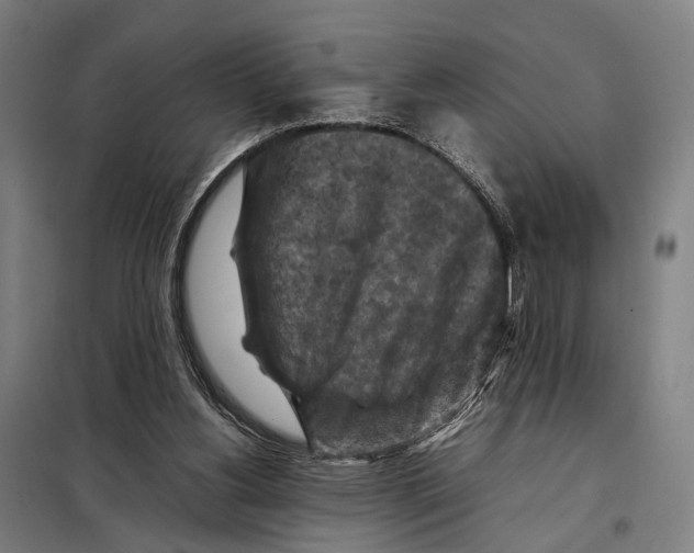 X0000097920156200804041532