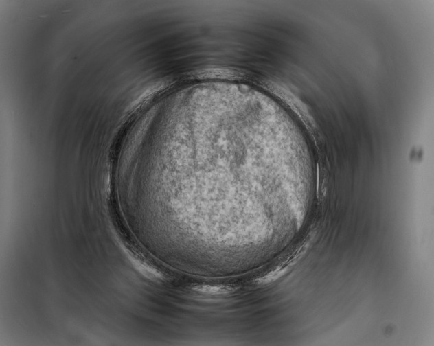 X0000097920157200804041532