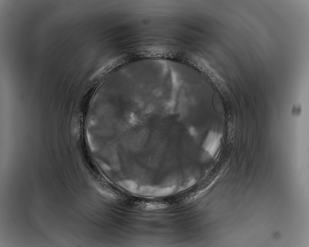 X0000097920165200804041532