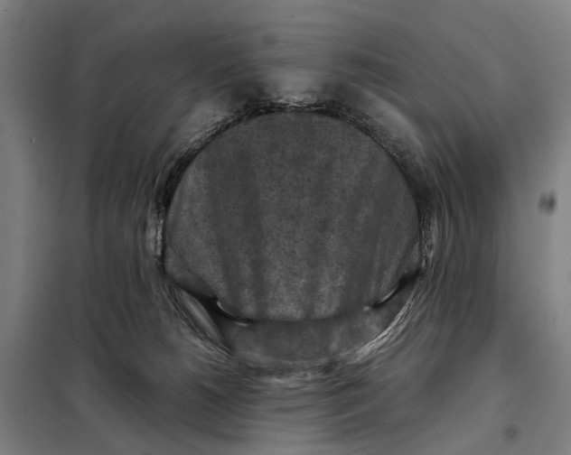 X0000097920180200804041532